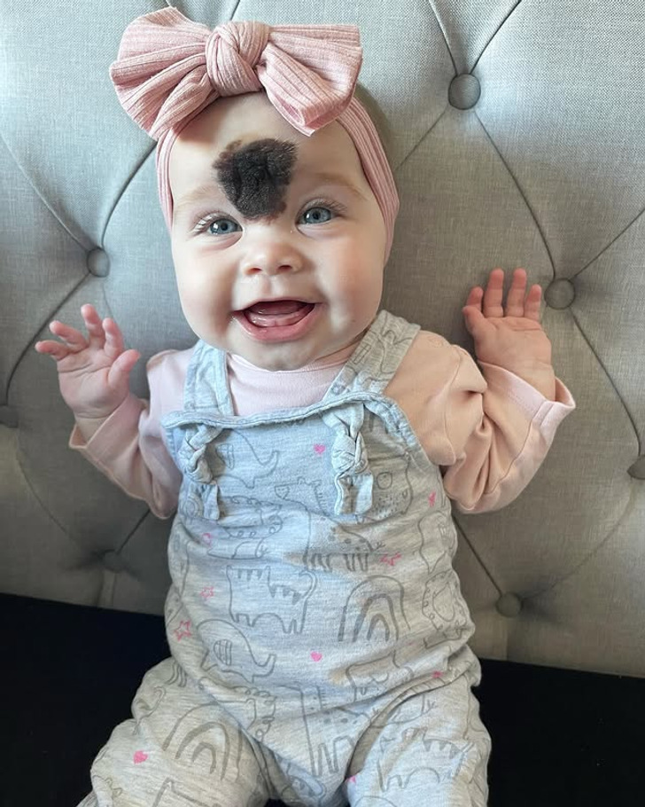 A baby girl with a brown birthmark on her forehead smiling and wearing a pink bow on her head.