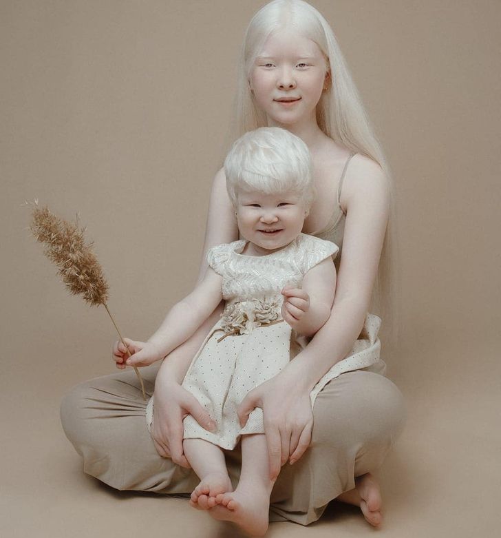 Deux sœurs albinos nées à 12 ans d’intervalle agitent la toile avec leurs photos
