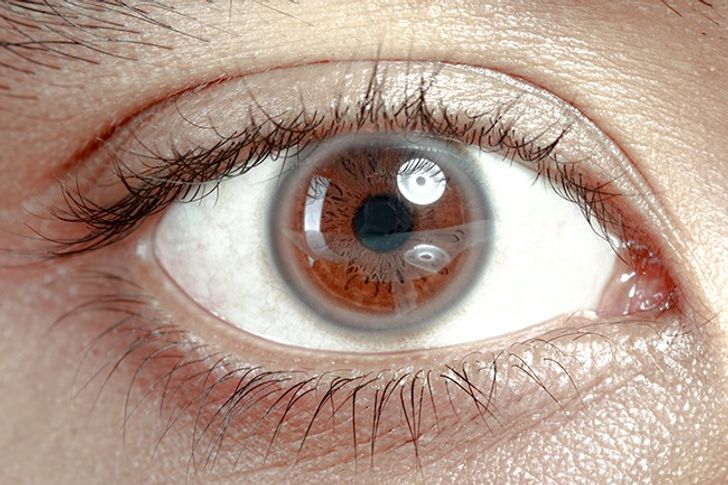 12 Choses Que Tes Yeux Revelent Sur Ta Sante