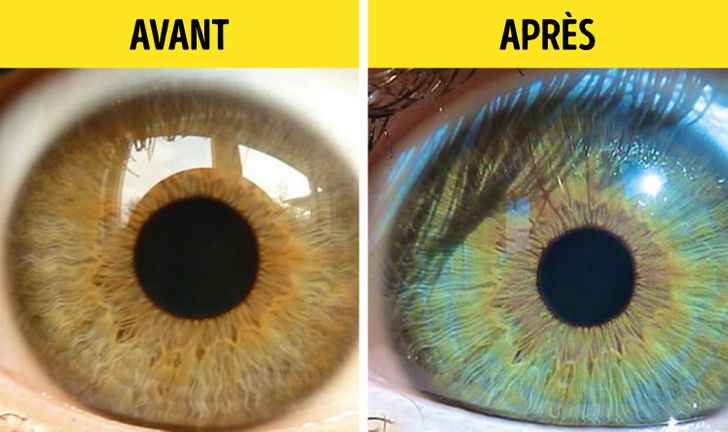 7 choses qui peuvent changer la couleur de tes yeux sympa
