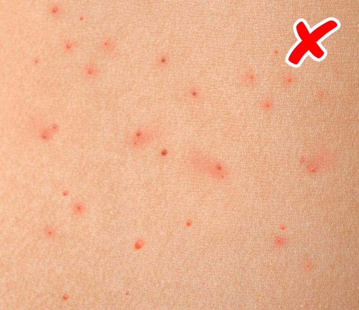 8 Maladies graves que notre peau nous signale